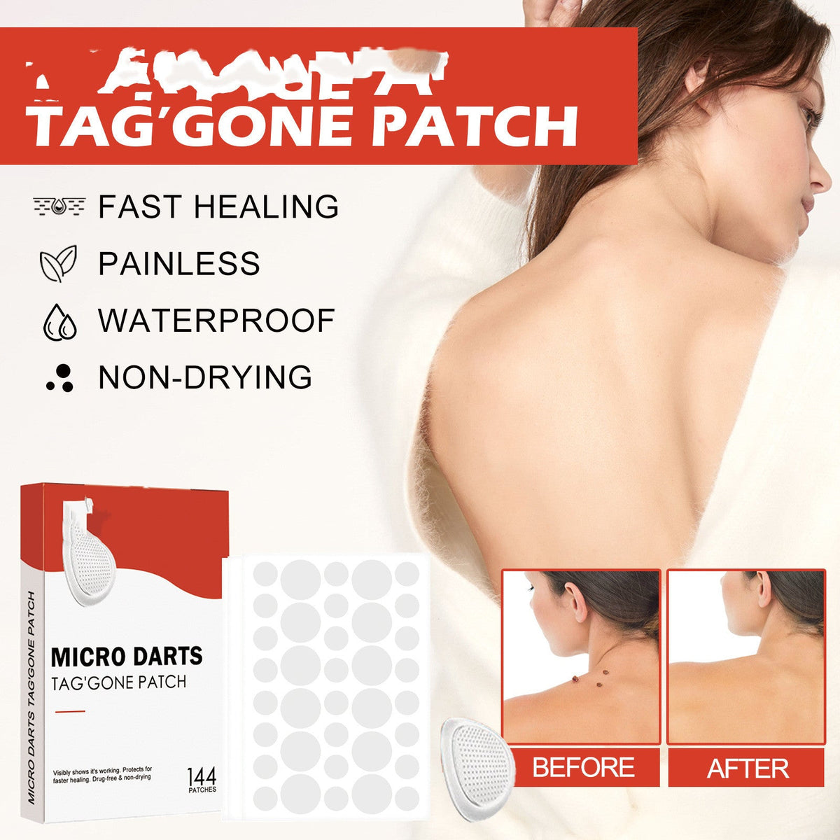 Acne Patch view 4