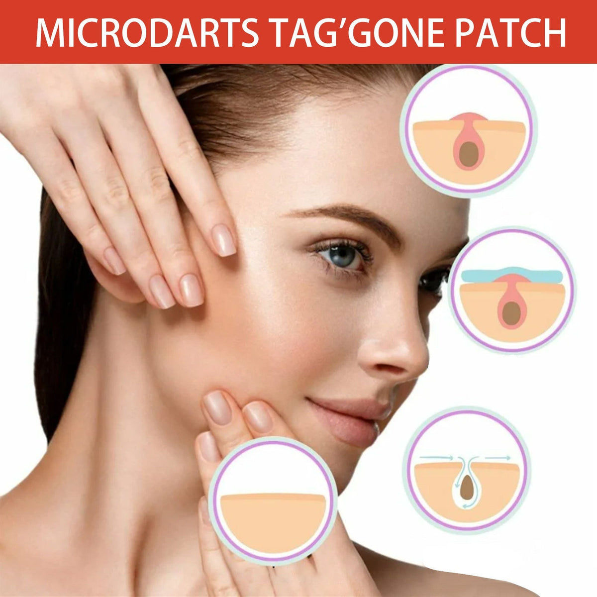 Acne Patch view 6