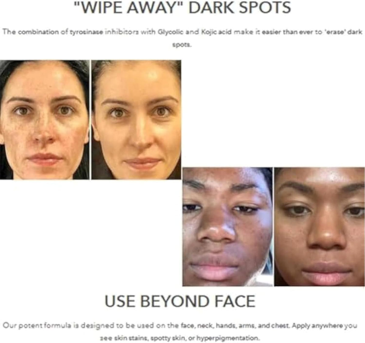Dark Spot Repair Lotion view 3