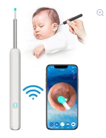 Earwax Removal Kit view 8