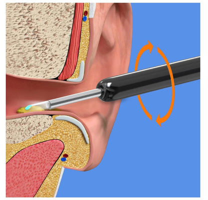 Earwax Removal Kit view 6