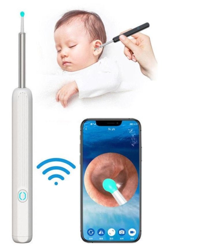 Earwax Removal Kit – Smart Visual Camera